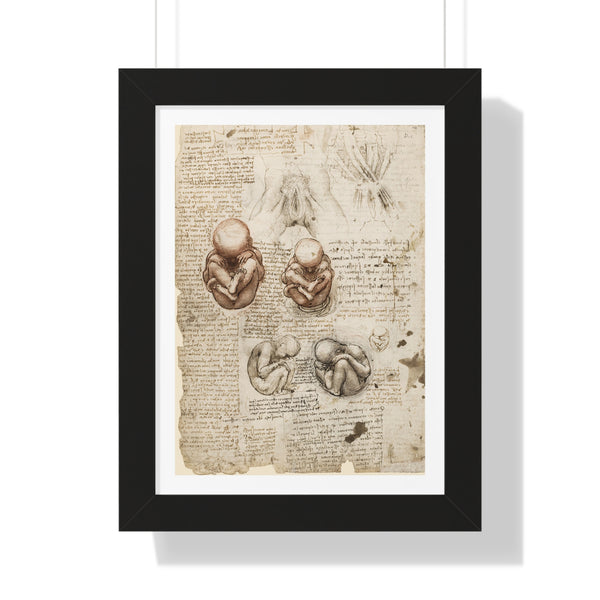 Position of the Fetus in the Womb by Leonardo da Vinci - Framed Print - Zapista